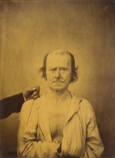 Attention (left); Reflection (right), 1854-1856, printed 1862. Creator: Duchenne de Boulogne