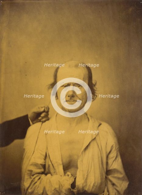 Attention (left); Reflection (right), 1854-1856, printed 1862. Creator: Duchenne de Boulogne.