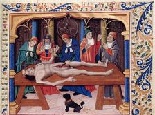 Autopsy. From Livre des propriétés des choses by Barthélemy l'Anglais, 15th century. Creator: Anonymous