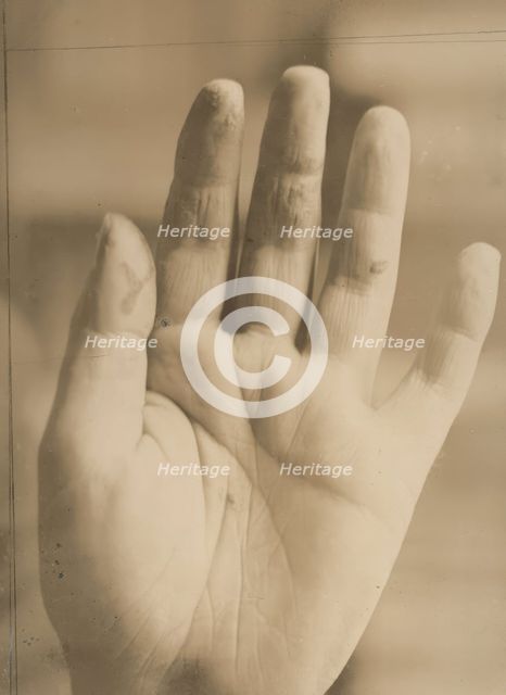August Strindberg's hand with the inscription "Photographie aufgenommen im Hôpital Saint..., 1895. Creator: Julien Leclercq.