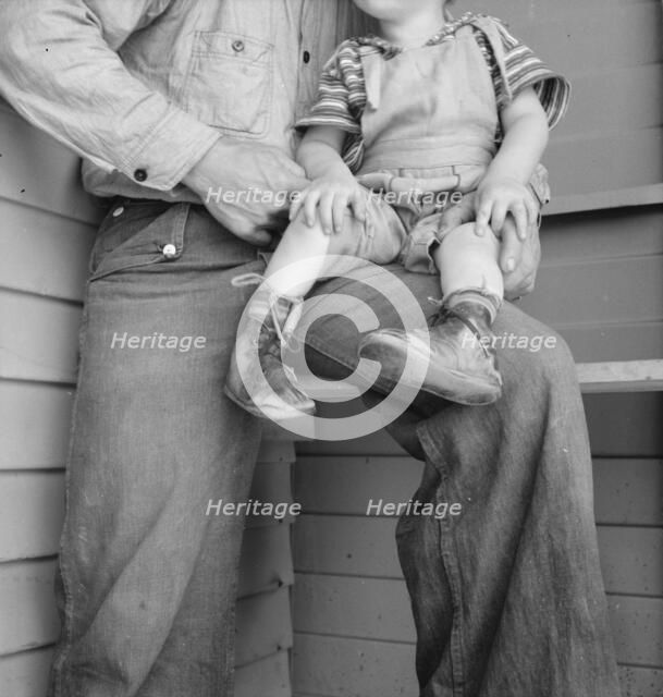Baby with club feet wearing homemade splints, FSA camp, Tulare County, California, 1939. Creator: Dorothea Lange.