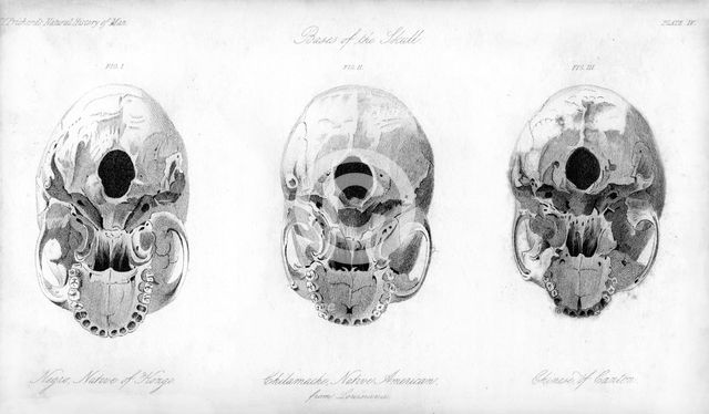 Base of the skull, 1848. Artist: Unknown