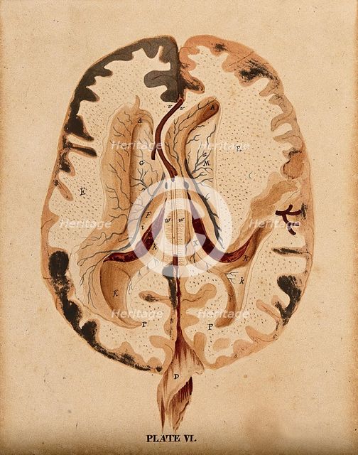 Brain: horizontal section showing lateral ventricles, 1820-1827. Creator: William Home Lizars.