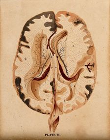 Brain: horizontal section showing lateral ventricles, 1820-1827. Creator: William Home Lizars