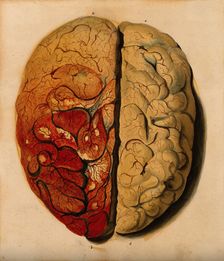 Brain: view from above, showing the gyri, with one hemisphere covered with pia mater, 1820-1827. Creator: Unknown