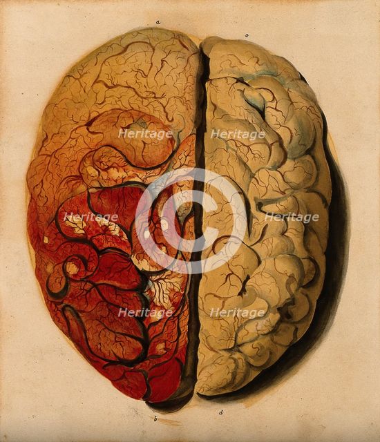 Brain: view from above, showing the gyri, with one hemisphere covered with pia mater, 1820-1827. Creator: Unknown.