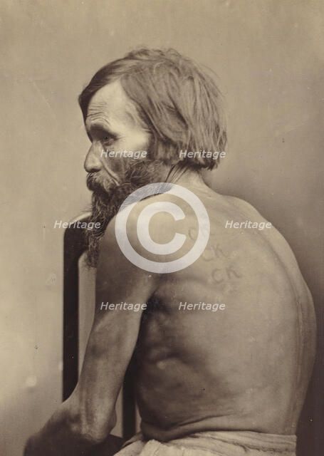 Branding on the Cheeks and Back of Forced Labor Convicts and on the Arms of a Vagrant, 1891. Creator: Aleksei Kuznetsov.