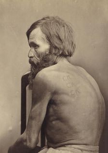 Branding on the Cheeks and Back of Forced Labor Convicts and on the Arms of a Vagrant, 1891. Creator: Aleksei Kuznetsov