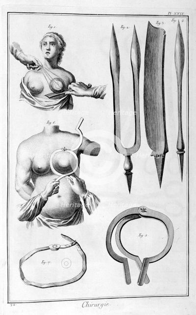 Breast surgery, 1751-1777. Artist: Unknown