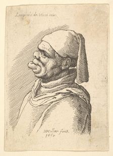 Bust of a deformed man with a hat and a fat, protruding lower lip in profile to left, 1625-77. Creator: Wenceslaus Hollar