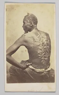 Gordon Under Medical Inspection, 1863. Creator: McPherson & Oliver