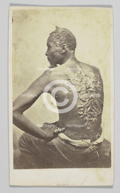 Gordon Under Medical Inspection, 1863. Creator: McPherson & Oliver.