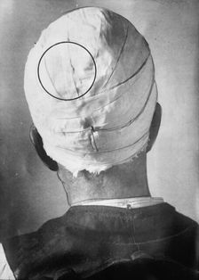 George Kimmel, between c1910 and 1912. Creator: Bain News Service