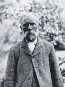 Gloucester smallpox epidemic, 1896: George Steel, a smallpox patient, 1896. Creator: HCF of Gloucester