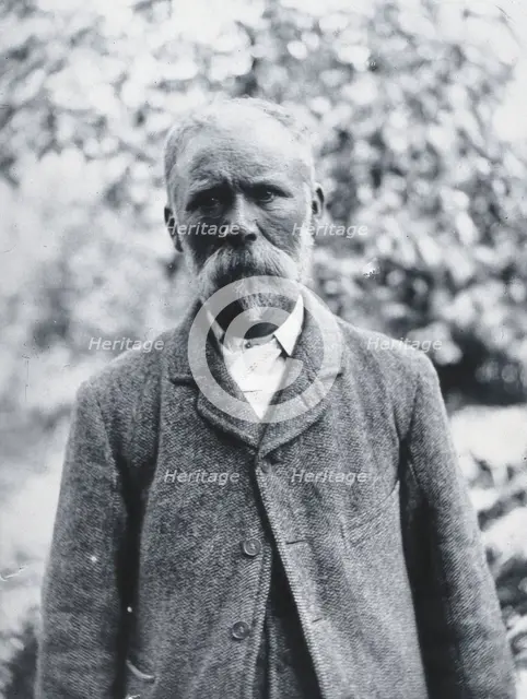 Gloucester smallpox epidemic, 1896: George Steel, a smallpox patient, 1896. Creator: HCF of Gloucester.