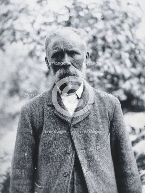 Gloucester smallpox epidemic, 1896: George Steel, a smallpox patient, 1896. Creator: HCF of Gloucester.