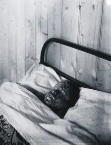 Gloucester smallpox epidemic, 1896: Kate Mills, a smallpox patient, 1896. Creator: HCF of Gloucester
