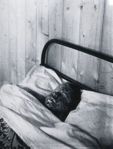 Gloucester smallpox epidemic, 1896: Kate Mills, a smallpox patient, 1896. Creator: HCF of Gloucester
