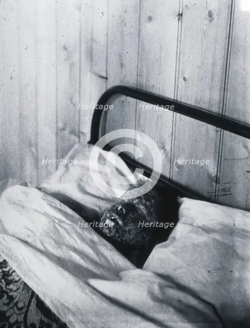 Gloucester smallpox epidemic, 1896: Kate Mills, a smallpox patient, 1896. Creator: HCF of Gloucester.