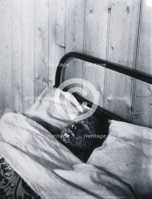 Gloucester smallpox epidemic, 1896: Kate Mills, a smallpox patient, 1896. Creator: HCF of Gloucester.
