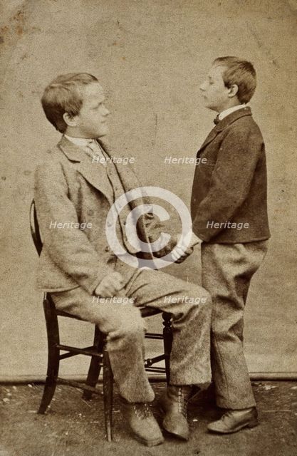 Down's syndrome: in two young men holding hands, one sitting and one standing, c1880s. Creator: Unknown.