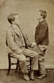 Down's syndrome: in two young men holding hands, one sitting and one standing, c1880s. Creator: Unknown