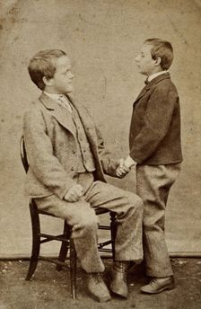 Down's syndrome: in two young men holding hands, one sitting and one standing, c1880s. Creator: Unknown