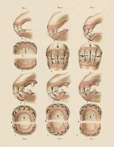 Description of Plate Showing the Age, As Indicated By The Teeth c1879. Creator: Unknown