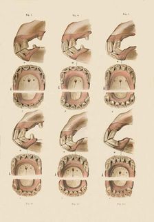 Description of Plate Showing the Age, As Indicated By The Teeth c1879. Creator: Unknown