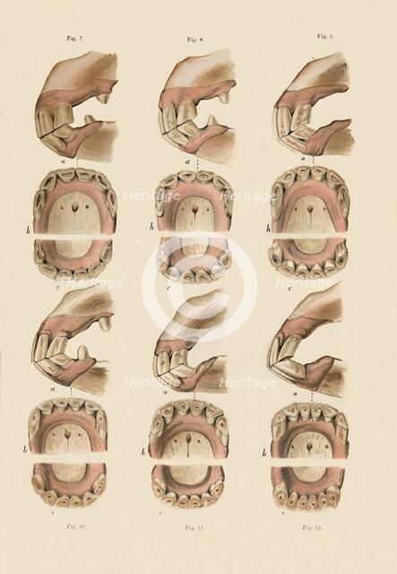 'Description of Plate Showing the Age, As Indicated By The Teeth', c1879. Creator: Unknown.