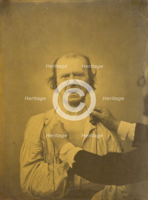 Discontent, bad humor, 1854-1856, printed 1862. Creator: Duchenne de Boulogne.