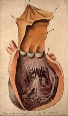 Dissected heart: section of the left ventricle, 1800-1899. Creator: Unknown