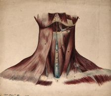 Dissection of the back of the neck, 1854/03/16. Creator: J.C. Whishaw