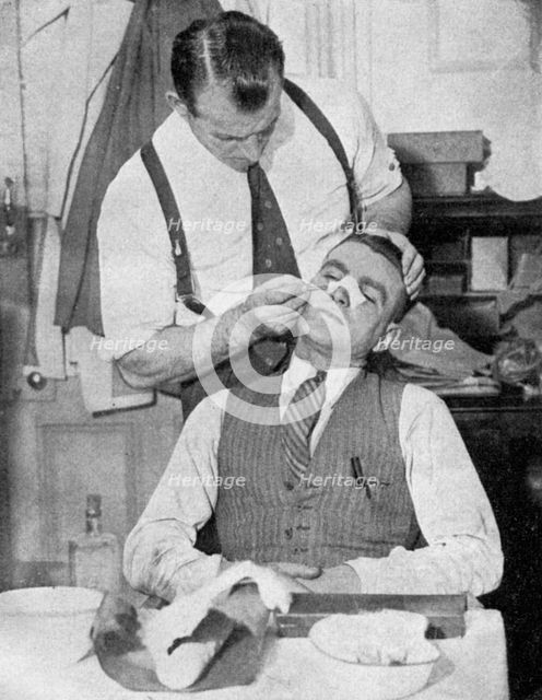 England captain Eddie Hapgood receives treatment for a broken nose after a match with Italy, 1934.Artist: Topical Press Agency