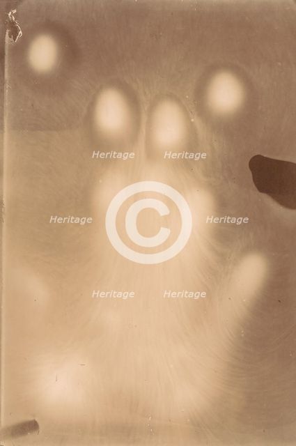 [Effluvia from a Hand Resting on a Photographic Plate], 1898-99. Creator: Adrien Majewski.