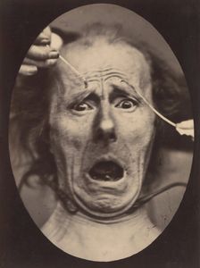 Electro-Physiologie, Figure 64, 1854-56, printed 1862. Creator: Adrien Alban Tournachon