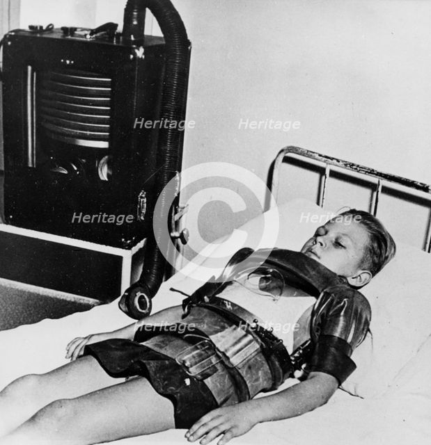 Eleven yeat old boy in an iron lung, Beaujon Hospital, Paris, c1947-1951 Artist: Unknown