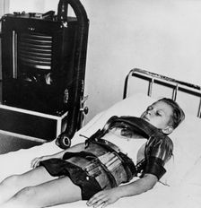Eleven yeat old boy in an iron lung, Beaujon Hospital, Paris, c1947-1951