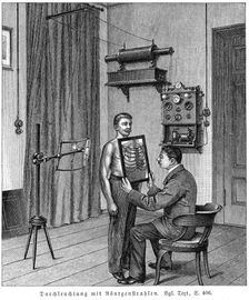 Examining a patient's thorax using an X-ray tube and fluorescent screen, 1903. Creator: Unknown
