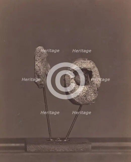 Excised Knee Joint. A Round Musket Ball in the Inner Condyle of the Right Femur [Gardin..., 1866-67. Creator: William H. Bell.