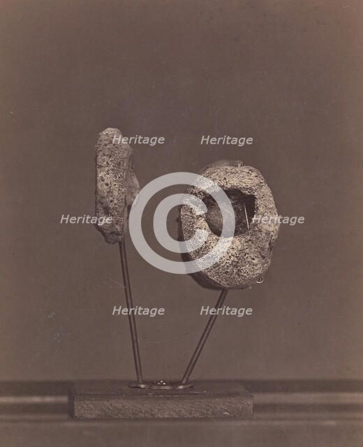 Excised Knee Joint. A Round Musket Ball in the Inner Condyle of the Right Femur [Gardin..., 1866-67. Creator: William H. Bell.