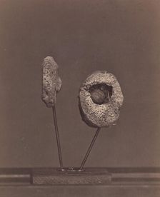 Excised Knee Joint. A Round Musket Ball in the Inner Condyle of the Right Femur [Gardin..., 1866-67. Creator: William H. Bell