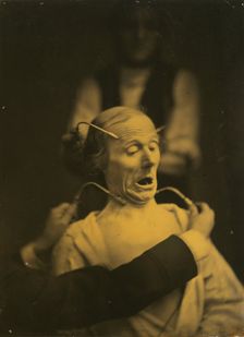 Expression of terror, 1854-1856, printed 1862. Creator: Duchenne de Boulogne