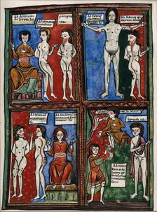 Four vignettes demonstrating different cauterisation points on naked human bodies. Creator: Unknown