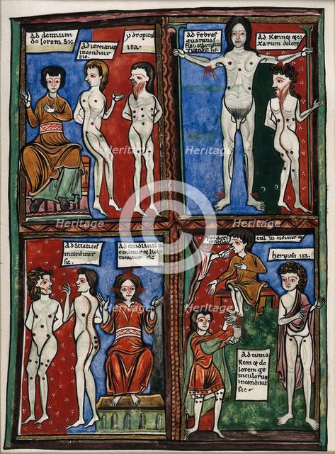 Four vignettes demonstrating different cauterisation points on naked human bodies. Creator: Unknown.