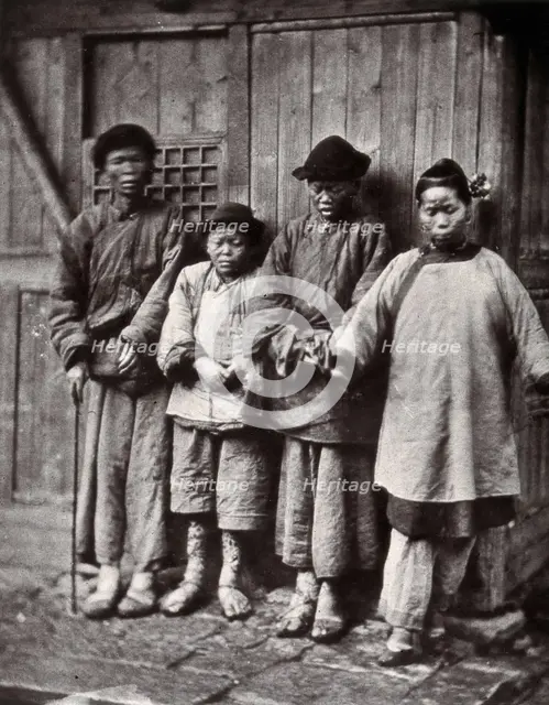 Foochow, China: four people with leprosy, wearing thick clothing, standing outside a wooden..., 1873 Creator: John Thomson.