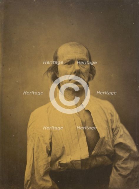 Face in repose, 1854-1856, printed 1862. Creator: Duchenne de Boulogne.