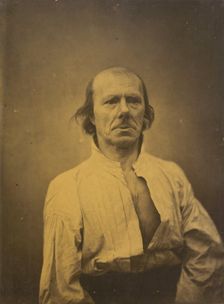 Face in repose, 1854-1856, printed 1862. Creator: Duchenne de Boulogne