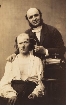 Faradisation du muscle frontal, 1854-56, printed 1862. Creators: Duchenne de Boulogne, Adrien Alban Tournachon