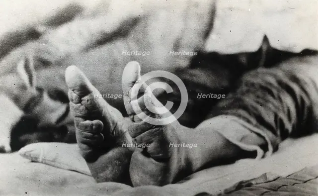 Feet of a Chinese woman, showing the effect of foot-binding, between 1900 and 1999. Creator: Unknown.